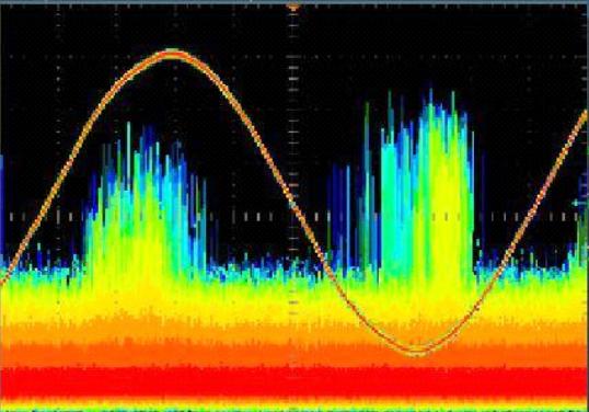 尖端放电-局部放电类型